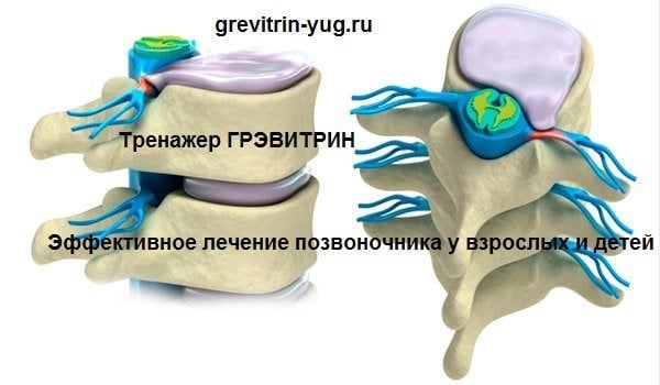 grevitrin-yug.ru - Домашний тренажер для позвоночника Грэвитрин