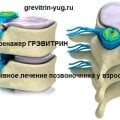 Домашний тренажер для позвоночника Грэвитрин